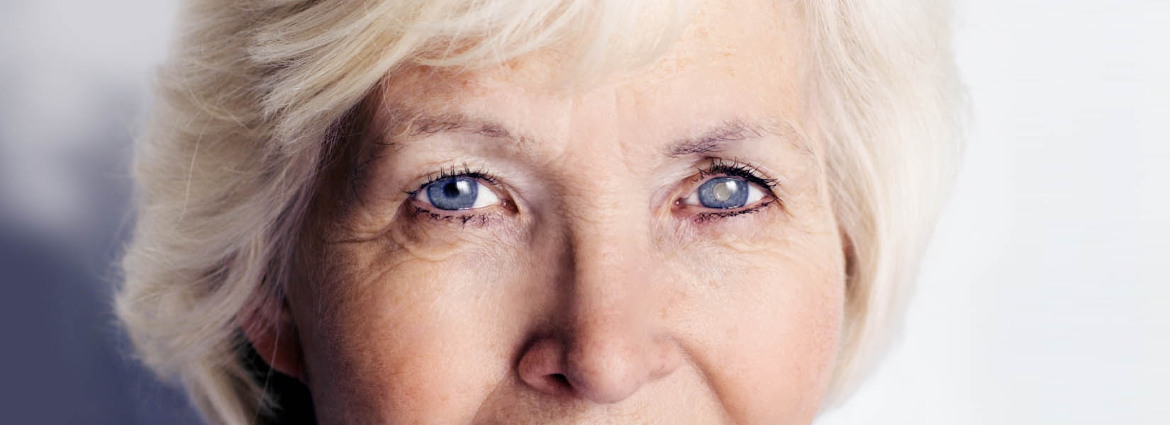 Cataract Surgery in Bridgeport